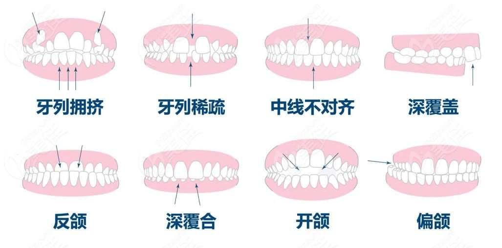  What stomatological hospitals are good orthodontists in Guancheng District, Dongguan