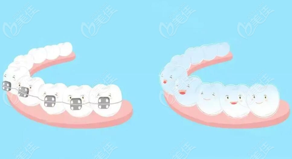  Yibin Dental Charging Standard