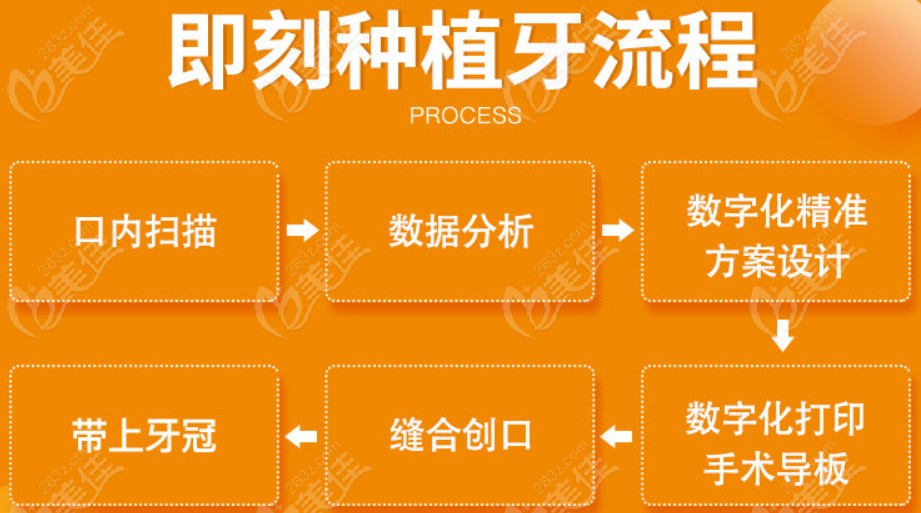 谁说种牙不要弄那种即拔即种的