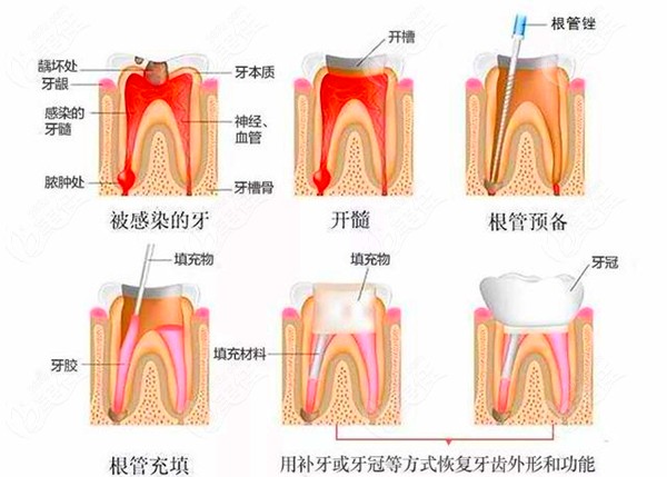  The charging standard of Anshun Dental Hospital has been adjusted