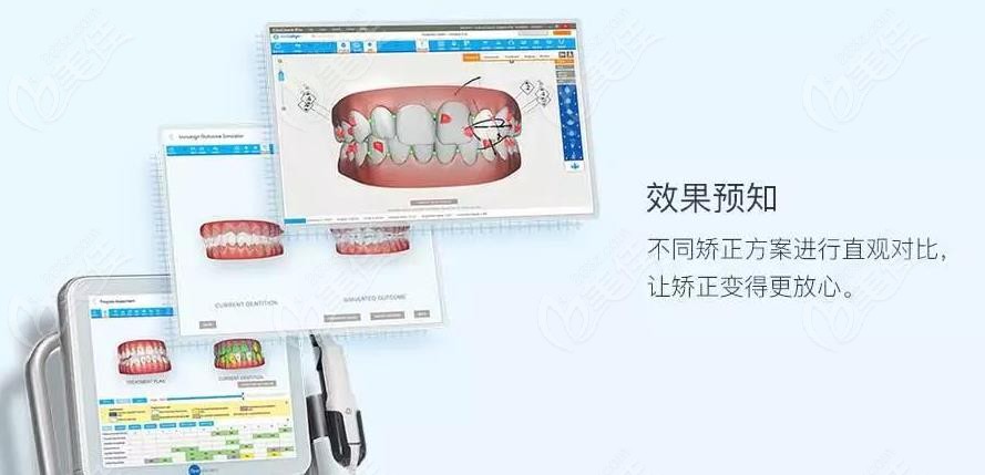  How about orthodontics in Baoji White Rabbit