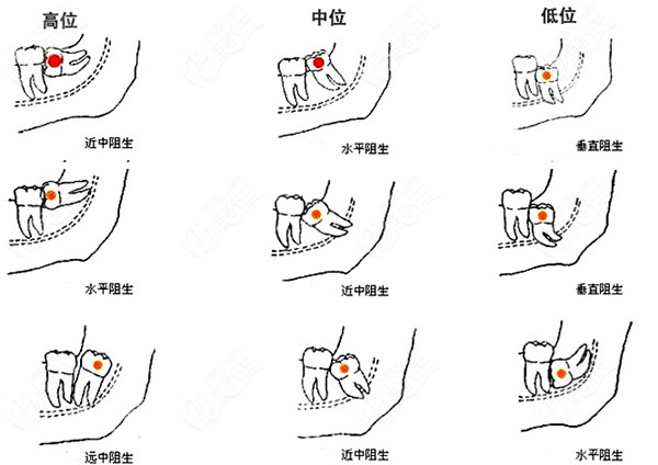  The charging standard of Anshun Dental Hospital has been adjusted