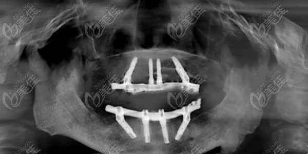  How about Doctor Sha's oral reputation in Dalian