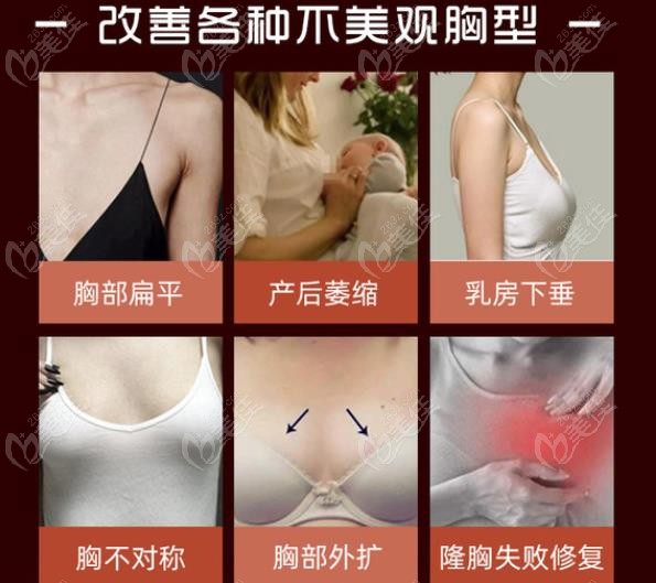  How about Hefei Huamei Doctor Zhao Ji doing breast augmentation with prosthesis