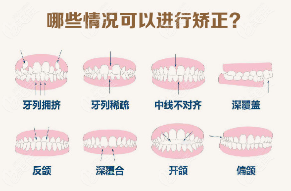  Hefei Beijie Dental Orthodontics Price List