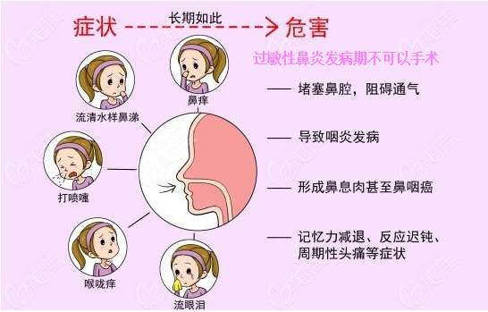 我有鼻窦炎可以做隆鼻手术吗