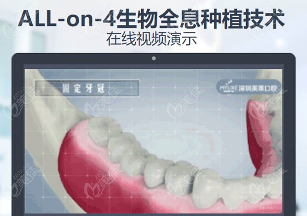  Where is Futian dental implant good in Shenzhen