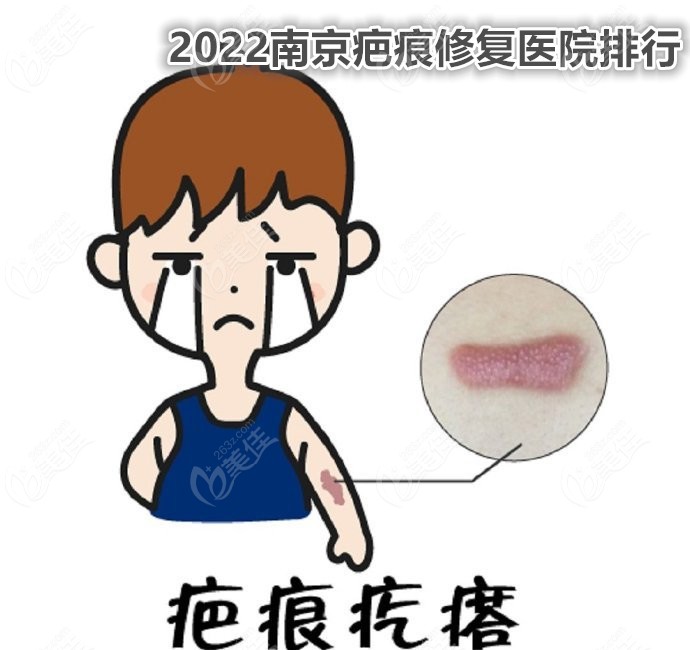  2022 Nanjing Scar Repair Hospital Ranking has changed