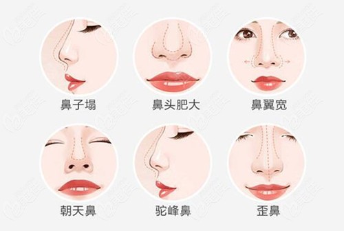  Publish the price list of Nanchang Yili plastic surgery