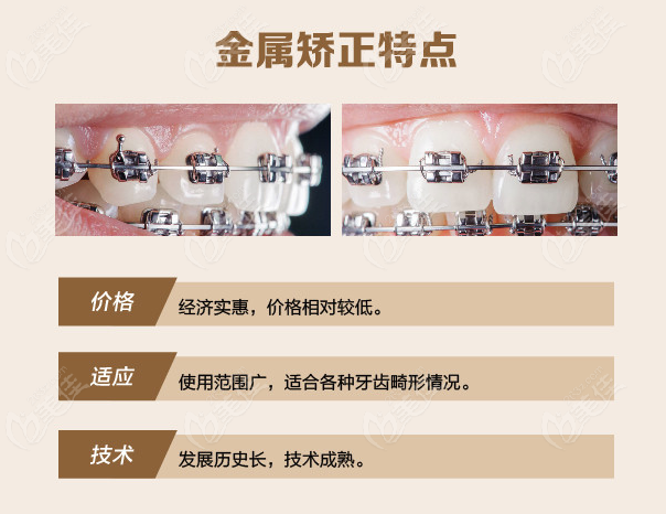  Hefei Beijie Dental Orthodontics Price List