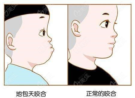  What stomatological hospitals are good orthodontists in Guancheng District, Dongguan