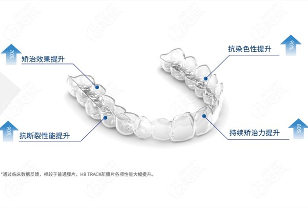 隐秀隐形矫正多少钱及它的优点有哪些可都在这哦