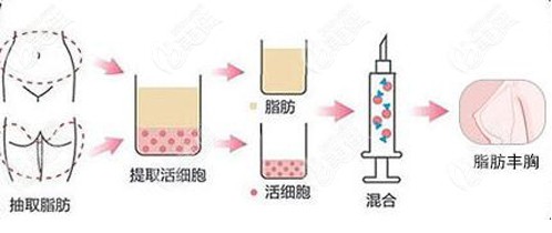  Among the top ten regular hospitals for plastic surgery in Qinghai, these hospitals are better for breast augmentation