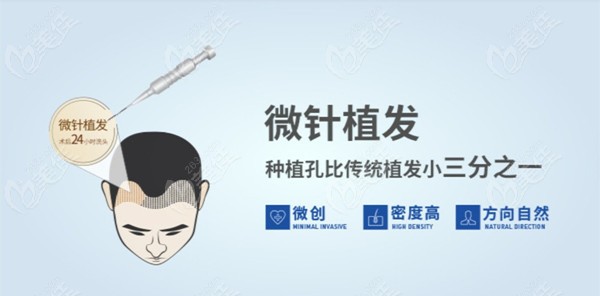  How much does the top four Guangdong hair specialist pay for 1000/2000/3000/5000 hair transplants