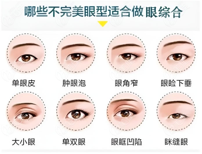  How much is it for Shanghai Huamei to have her eyelids cut