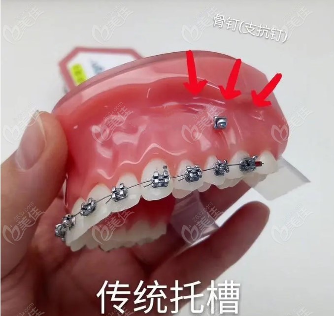  How much does Yiyang orthodontics cost