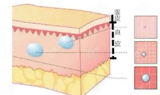  Kunming Hyaluronic Acid Injection Hospital ranked top 10