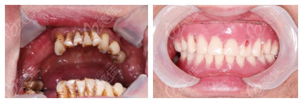  How about Quanzhou Weile dental implant