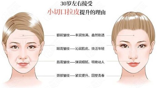  Who is the good doctor for skin pulling operation in Harbin