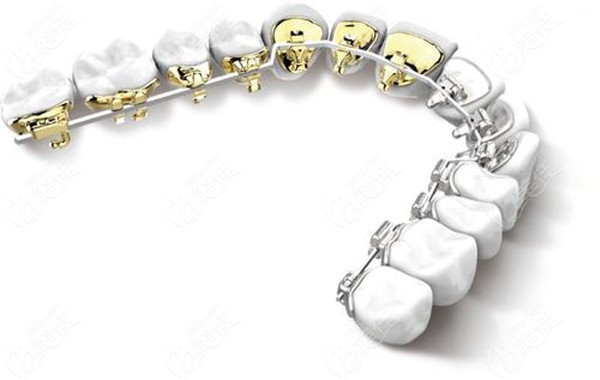  Do you want the orthodontic fees in the price list of Chongzuo Dental Hospital