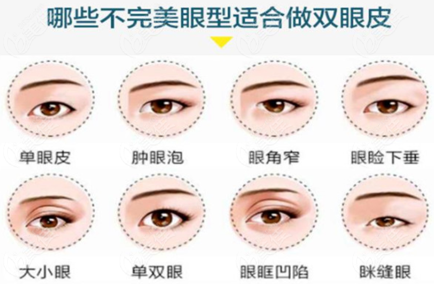  Which hospital in Yichun is better for double eyelids