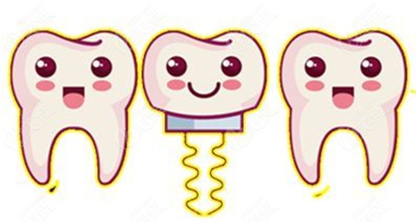  Wuhan Eya Oral Implant Tooth Price List is New