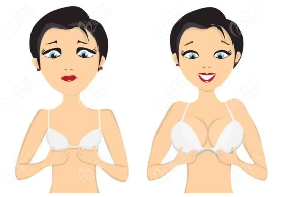  How to deal with nodules and hard lumps caused by failure of autologous fat breast augmentation