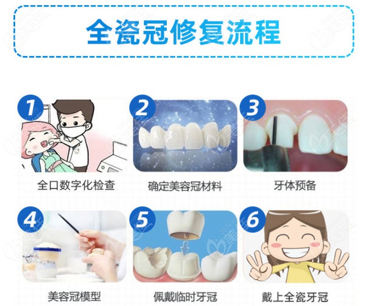 活髓全瓷牙的利与弊了解下