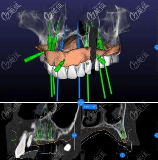  Changsha Meiao Oral Digital Implant Center was established