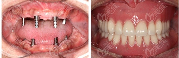  Wuhan Dental Implant Hospital Ranking Finalized