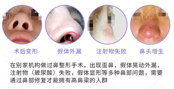  The price list of Tongren Xingwei Spring Medical Beauty can also show how the hospital is