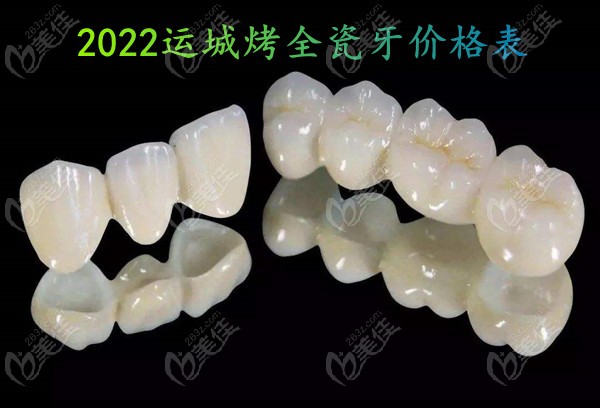  2022 Yuncheng baked all ceramic teeth price list has been updated