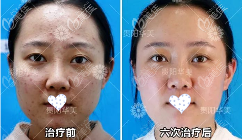  How do you evaluate Guiyang Huamei Zixin Plastic Surgery Hospital