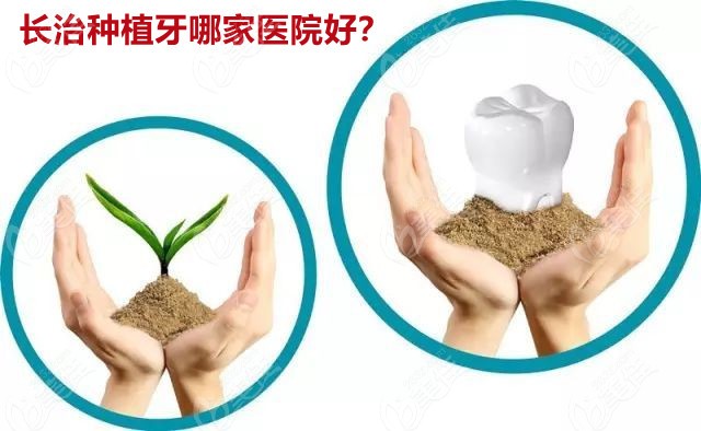  Which hospital is better for Changzhi dental implant