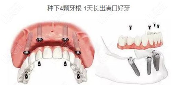  Wuhan Dental Implant Hospital Ranking Finalized