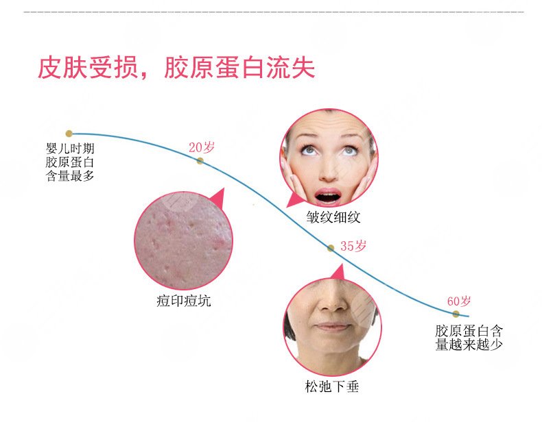 中山大学附属第一医院激光去痘坑怎么样