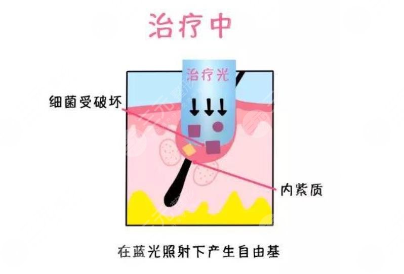  Is the beauty laser department of Zhongshan Third Hospital public