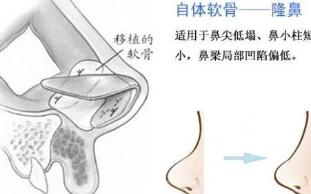 八大處整形醫(yī)院掛號當天可以直接做嗎