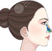 沈陽(yáng)名流美容醫(yī)院隆鼻怎么樣