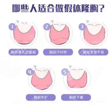 上海巨乳缩小医院排名