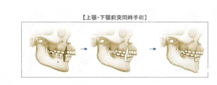 国内正颌手术医院排名盘点