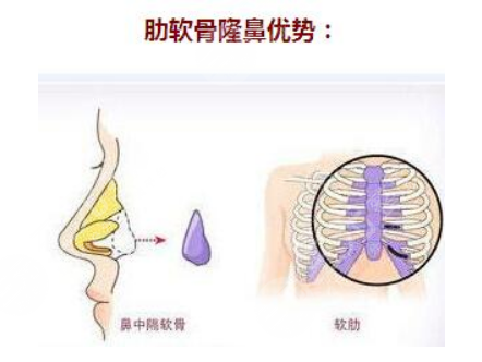 深圳艺星做鼻子怎么样