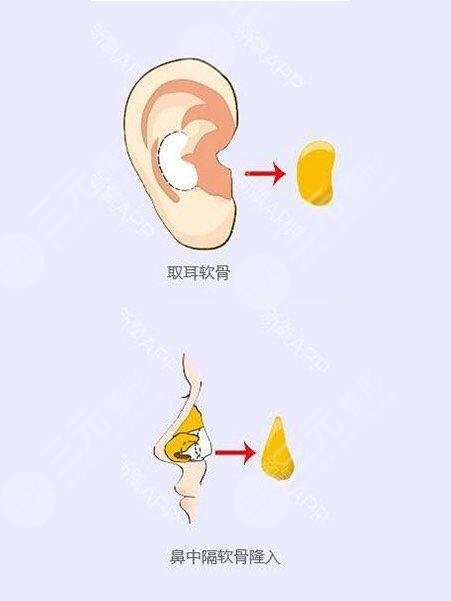 郑州大学第二附属医院整形科怎么样