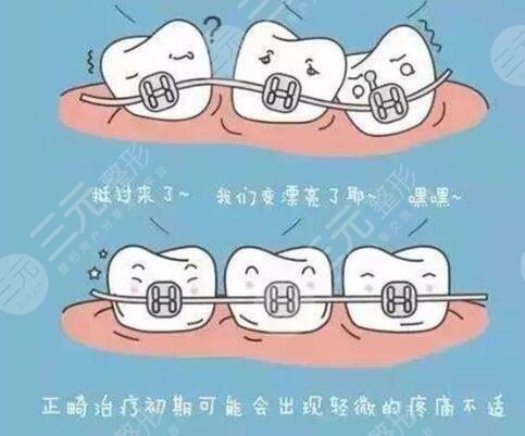 南京整牙齿哪个医院比较好