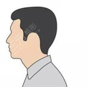 合肥長(zhǎng)庚醫(yī)院植發(fā)醫(yī)生名單匯總