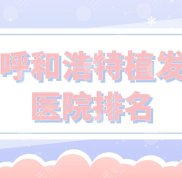 呼和浩特植發(fā)醫(yī)院排名