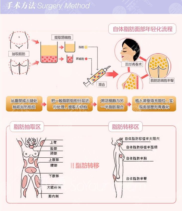 北京自体脂肪填充医院排名前三的名单公开
