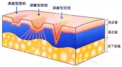 上海祛痘比较有名的医院