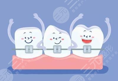 上海九院牙齿矫正费用影响因素有哪些
