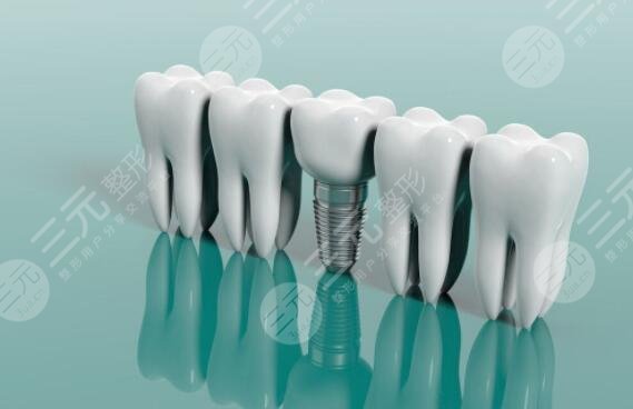 2022北京十大种植牙私立牙科排名